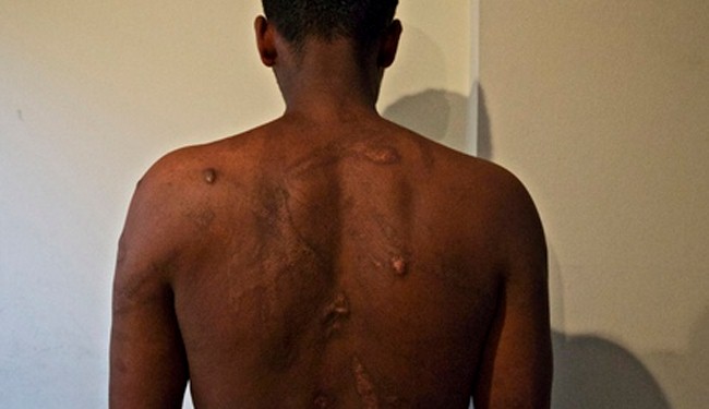 Eritreans suffer rape, violence in Sudan, Egypt torture camps