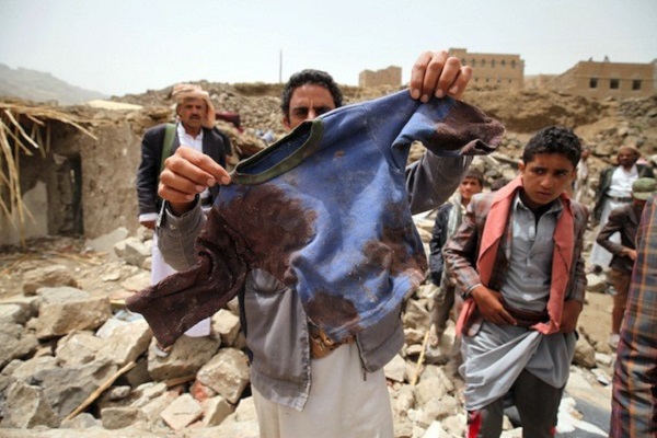 A man displays the bloodied shirt of a victim at the rubble of houses destroyed by an air strike in the Okash village near Sanaa