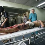 Palestinians injured by Israeli military attack
