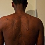 Eritreans suffer rape, violence in Sudan, Egypt torture camps
