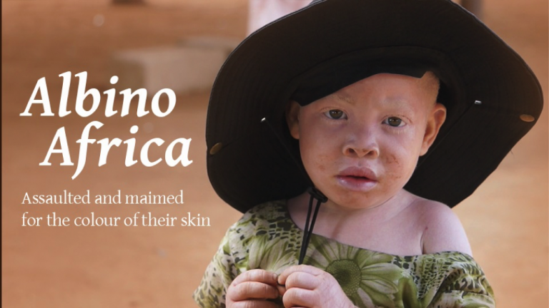 Tanzania: continua l’eccidio degli albini per foraggiare i riti tribali degli stregoni