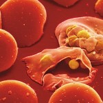 Attacco del Plasmodio della malaria