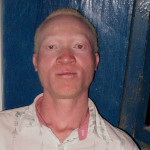 L’albino zeruzeru Robinson Mkwama