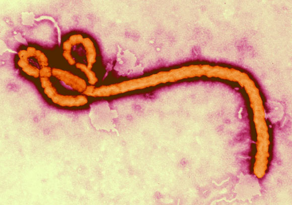 Filovirus ebola