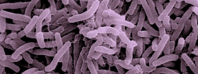 Vibrio cholerae visto al microscopio elettronico