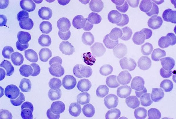 Vaccino RNA Plasmodio della malaria (Plasmodium malariae)