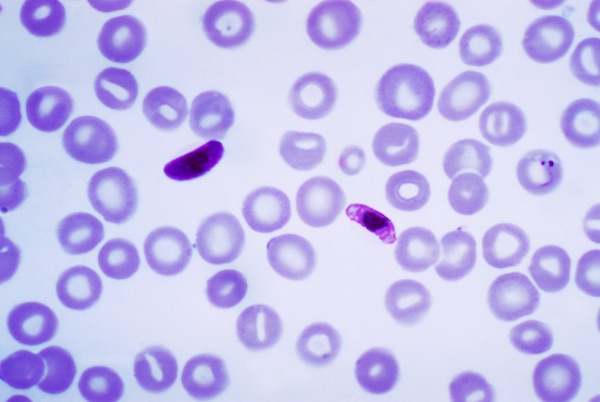 Il Plasmodium falciparum, il parassita che causa la malaria, visto al microscopio