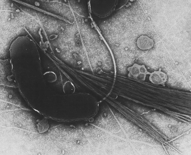 Vibrione del colera (Vibrio cholerae)