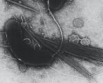 Vibrio_cholerae