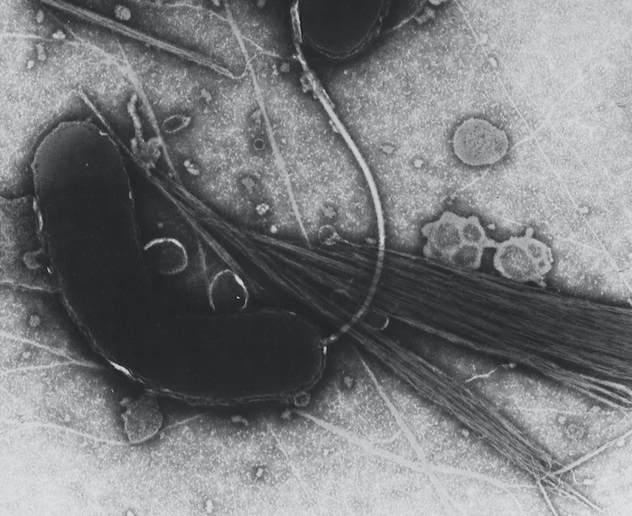 morti annegati Vibrio cholerae, 
