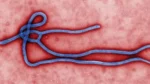 Electron-micrograph-ebolavirus-virion